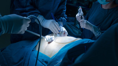 Gallbladder-Surgery.jpg