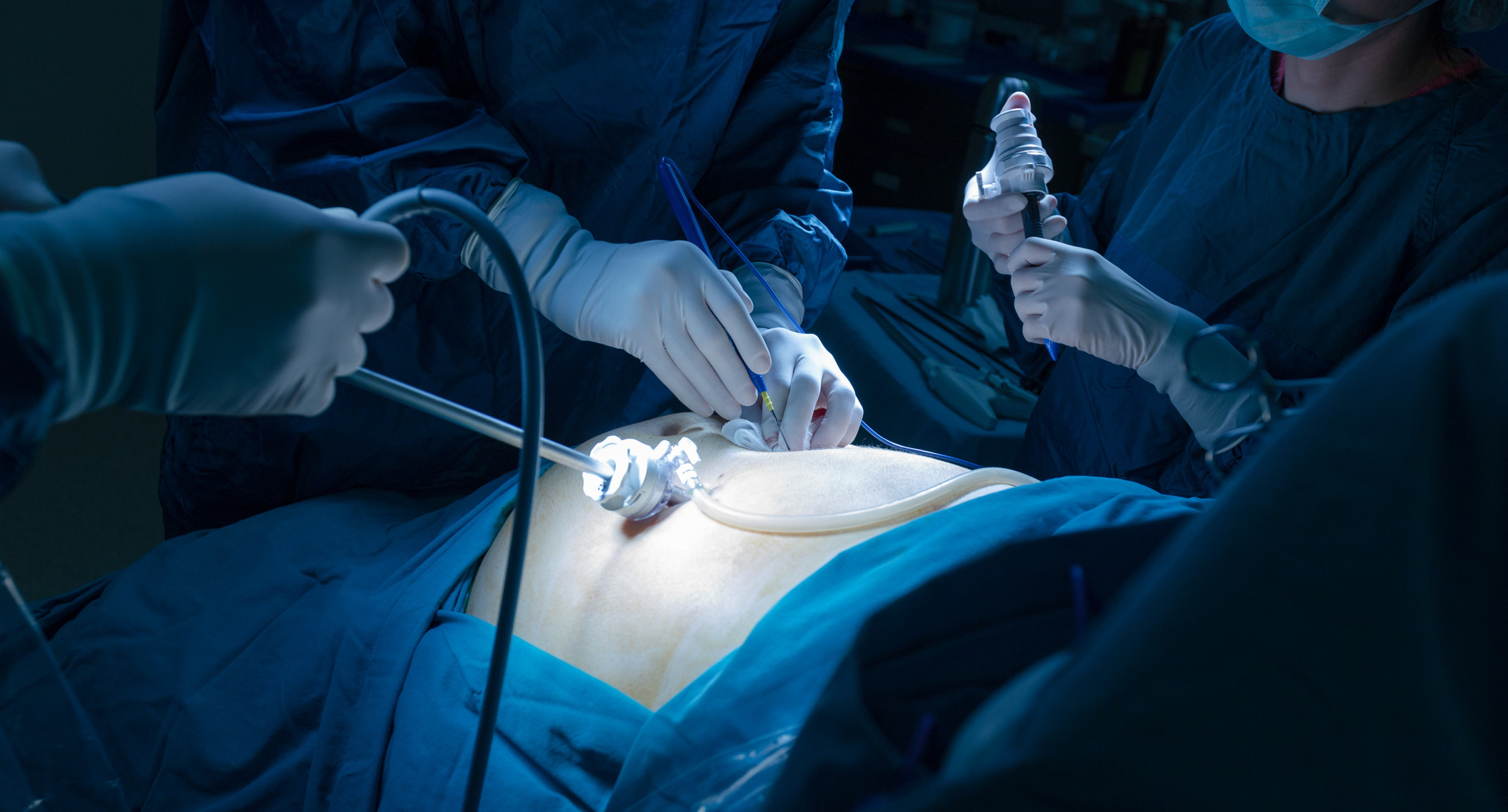 Gallbladder-Surgery.jpg