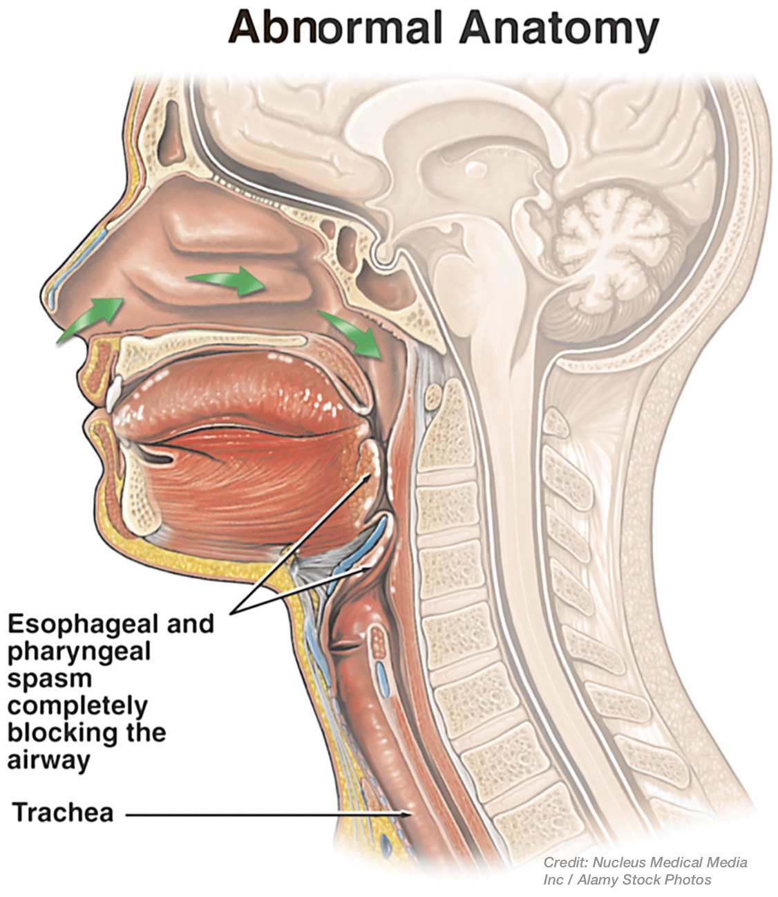 Airway-Anatomy.jpg