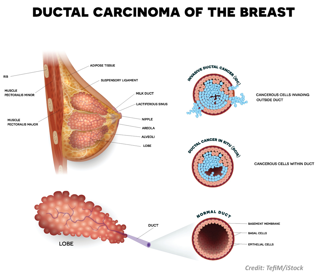 Cancer Misdiagnosis \u0026 Mistreatment | Clore Law Group, LLC, image size:1103x950